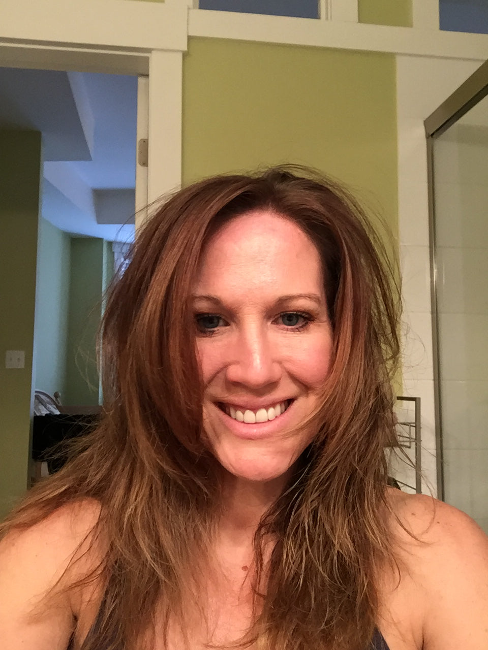 Janice’s hair starting to grow